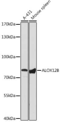 Western Blot: ALOX12B AntibodyAzide and BSA Free [NBP3-04581]